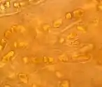 地衣Pyrenocollema halodytes,其中含有真菌菌絲的藍藻Hyella caespitosa。